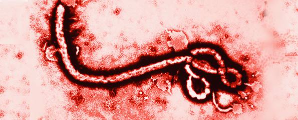 에볼라 바이러스(사진: Virtual Medical Centre)