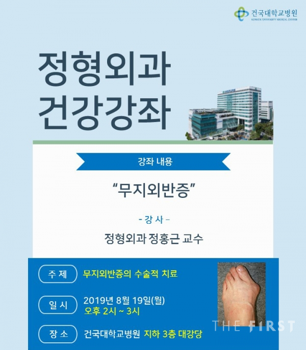 [의료계 소식] 건국대병원, 오는 19일 ‘무지외반증’ 건강강좌 개최