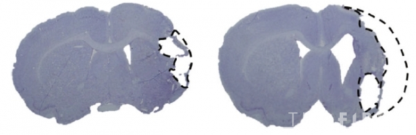 사진=유도만능줄기세포 유래 신경전구세포 이식한 그룹과 대조군의 뇌경색 부피 비교