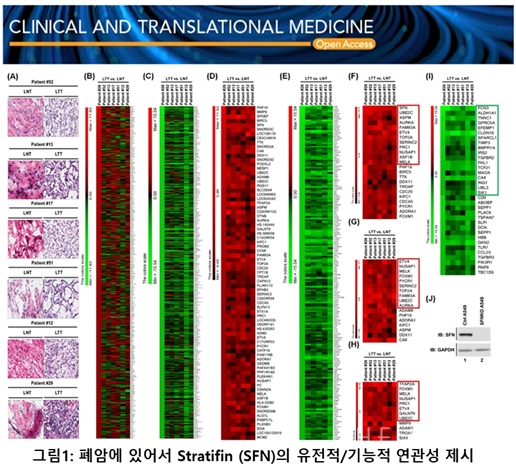 폐암에 있어서 SFN의 유전적 연관성 제시