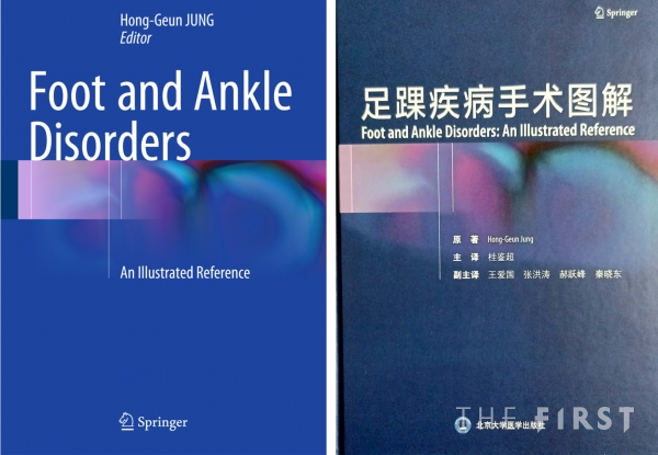 왼쪽)올해 8월에 출간한 중국어 번역판 ‘Foot and Ankle Disorders’.(오른쪽)지난 2016년 스프링거사에서 정홍근 교수 책임 저자로 출간한 ‘Foot and Ankle Disorders’.